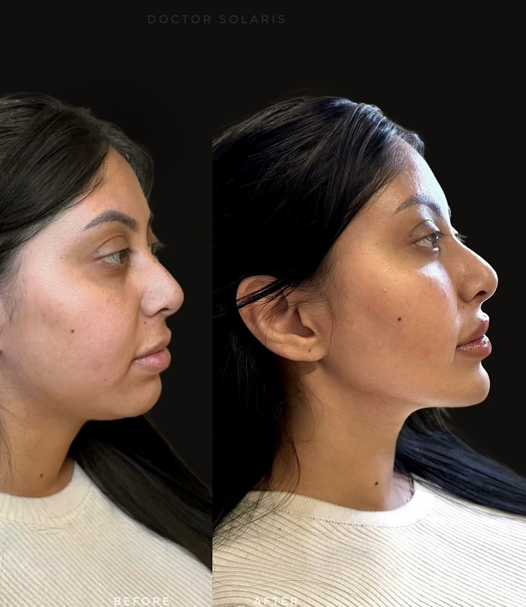 Facial Balancing