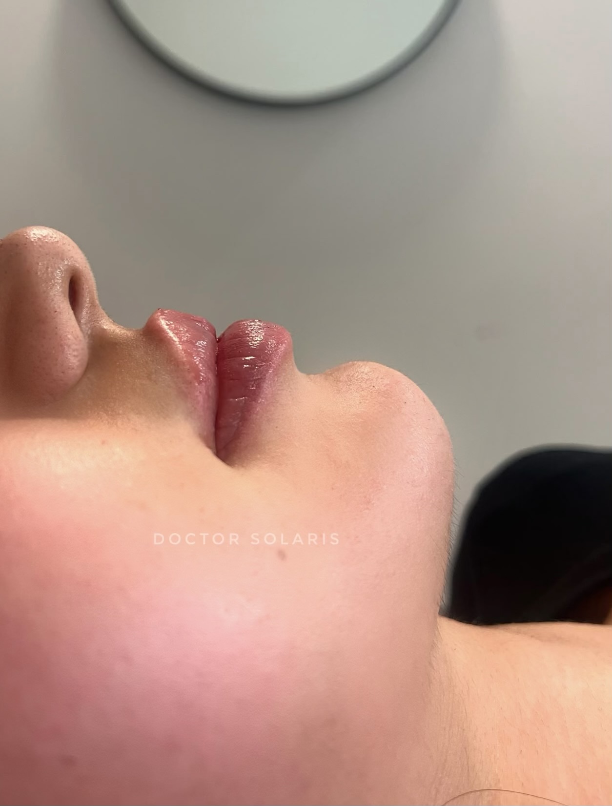 Russian Flat Lipfillers